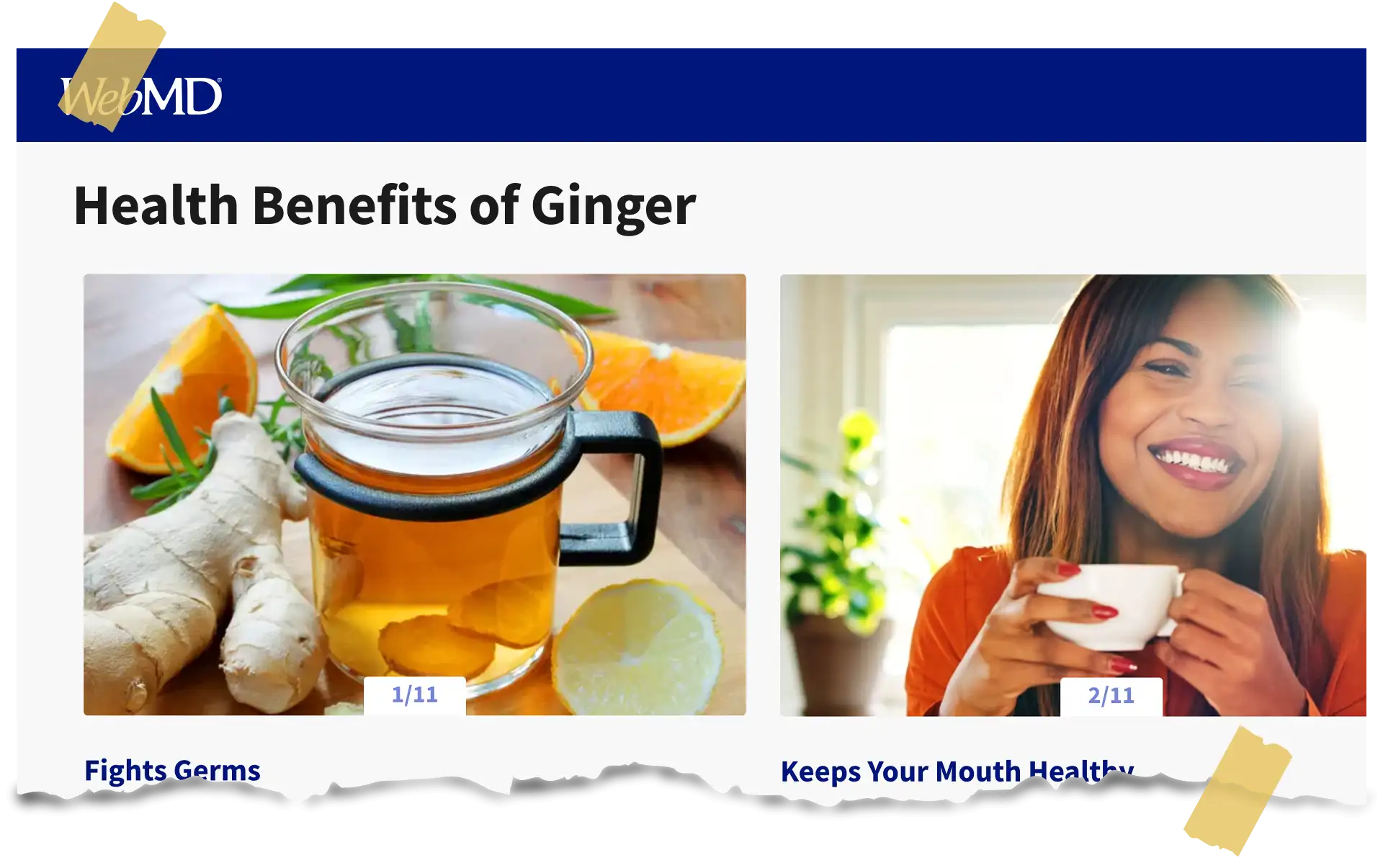 Ginger- The Power Ingredient For Gulpit - NEWS- WebMD